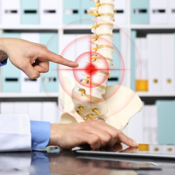 Spinal and Postural Screenings at Henry Chiropractic Pensacola