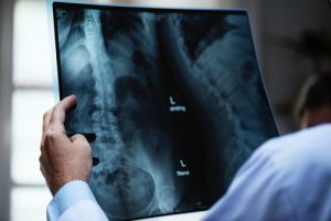 Spine X Ray-Chiropractor Pensacola